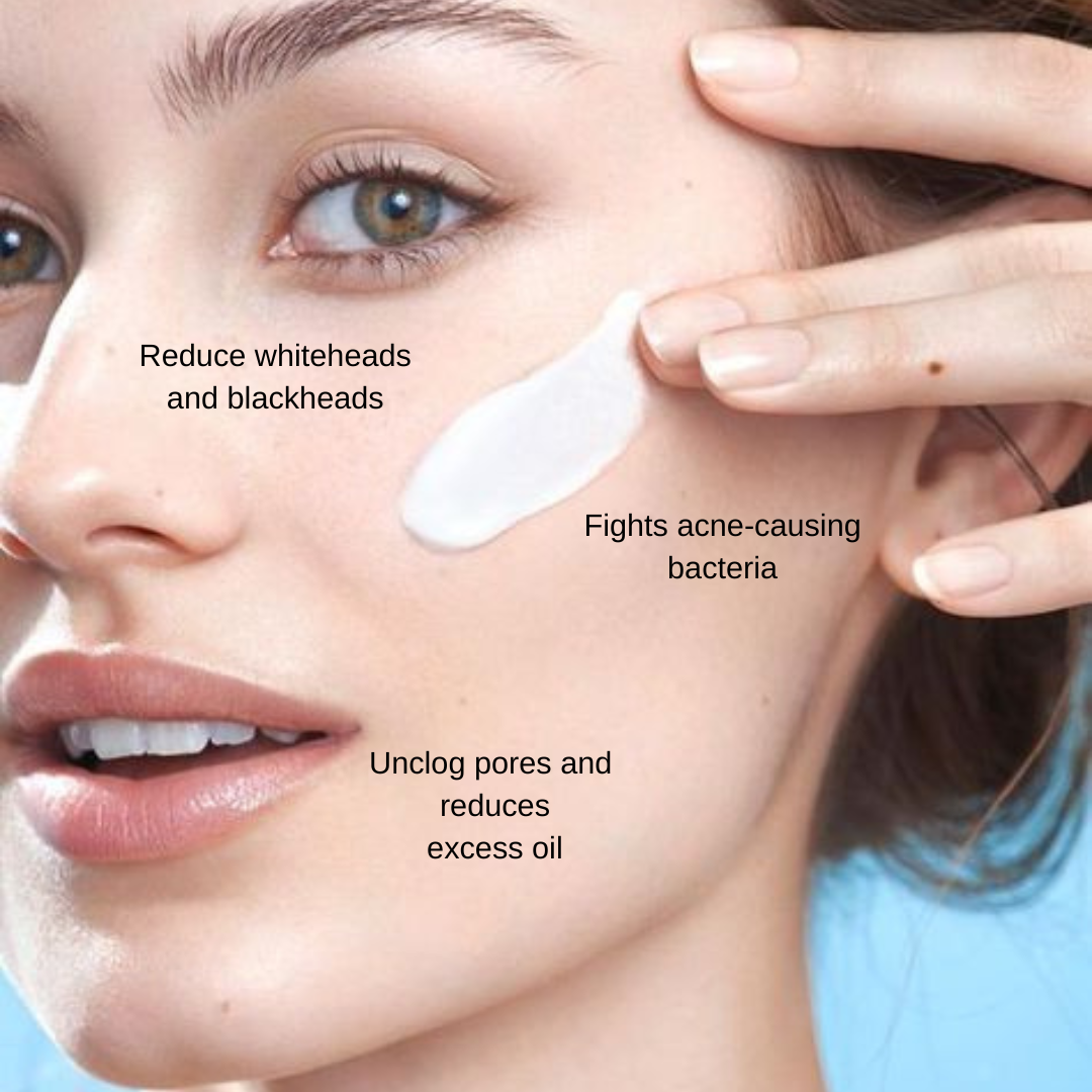 KLEAN | ACNE CONTROL CREAM