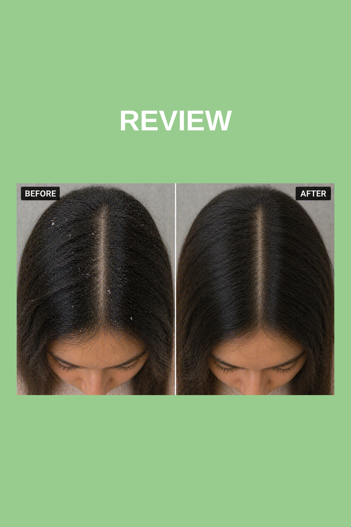 SELVIN | DANDRUFF DEFENSE SHAMPOO