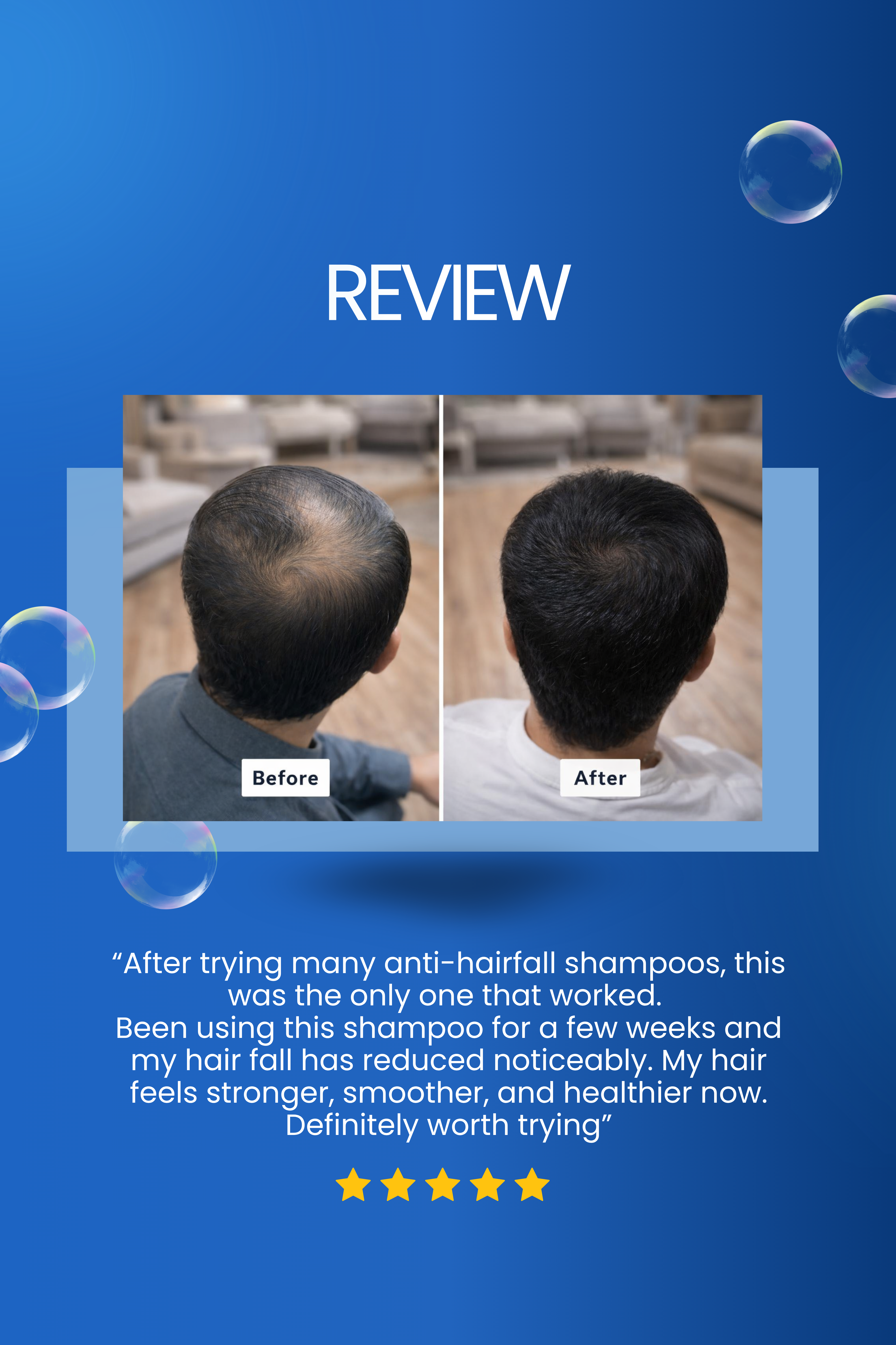 KERAFALL | KERATIN & ANTI-HAIRFALL SHAMPOO